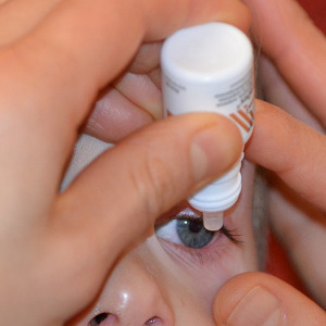 Adjunctive Treatment of Ocular Surface Dysplasia